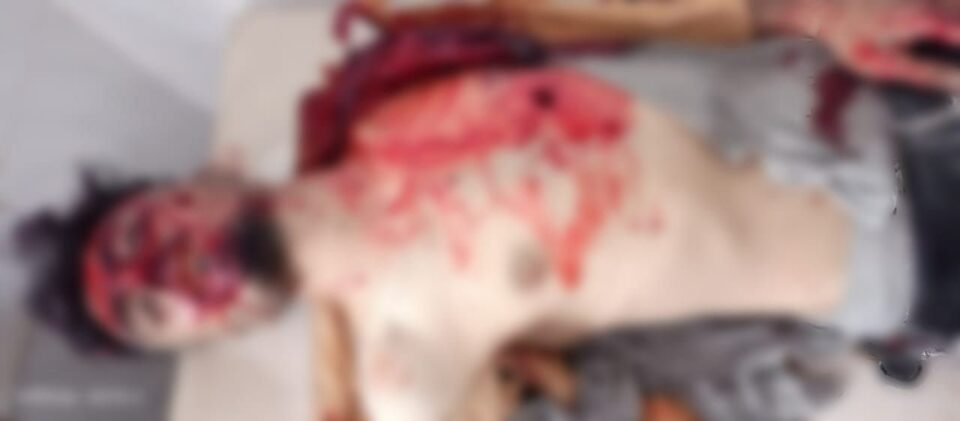 كوژران و برینداربوونی ٨ كه‌س له‌ هێرشی توركیا به‌سه‌ر ته‌ل ڕه‌فعه‌ت