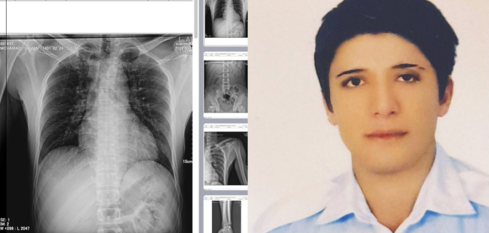 ناجێگیربوونی باری ته‌ندرووستی به‌ندكراوێكی خه‌ڵكی سنه‌ 1