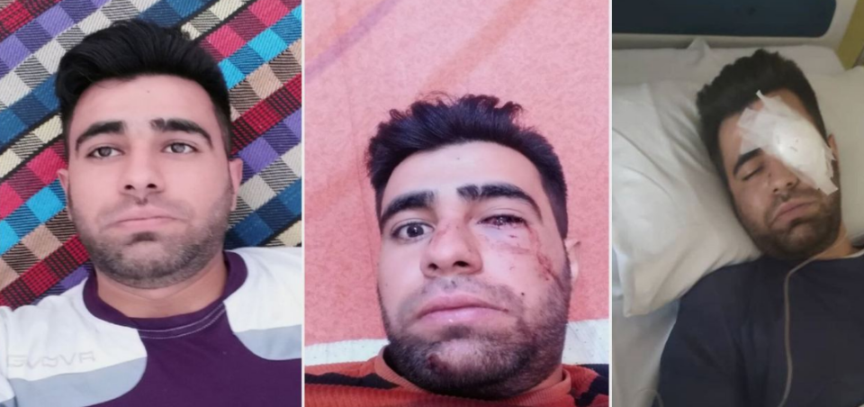 لەدەستدانی بینایی بریندارێکی شۆڕشی ژن، ژیان، ئازای لە شاری ئابدانان