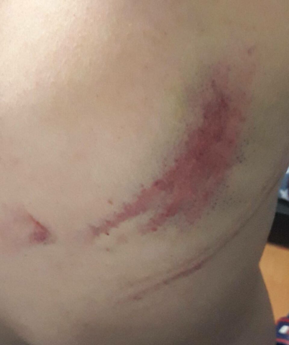 ئەشکەنجەدانی چالاکێكی سیاسیی کورد لە سنووری تورکیا 4