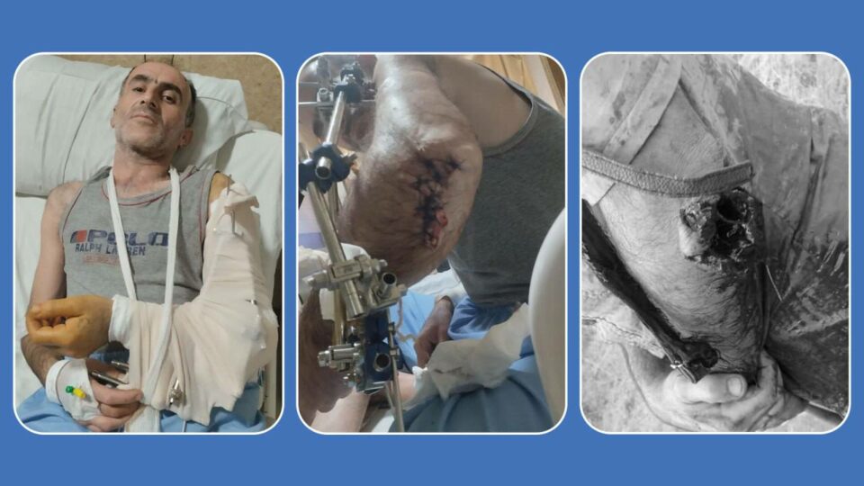 گواستنەوەی كۆڵبەرێك بەهۆی سەختی برینەکانی بۆ نەخۆشخانەیەكی تاران