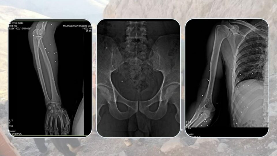 برینداربوونی كۆڵبه‌رێك له‌ سنووری نه‌وسوود 5