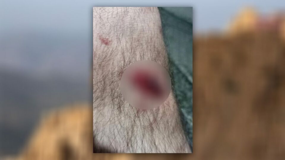 برینداربوونی كۆڵبه‌رێك له‌ سنووری نه‌وسوود 1 11