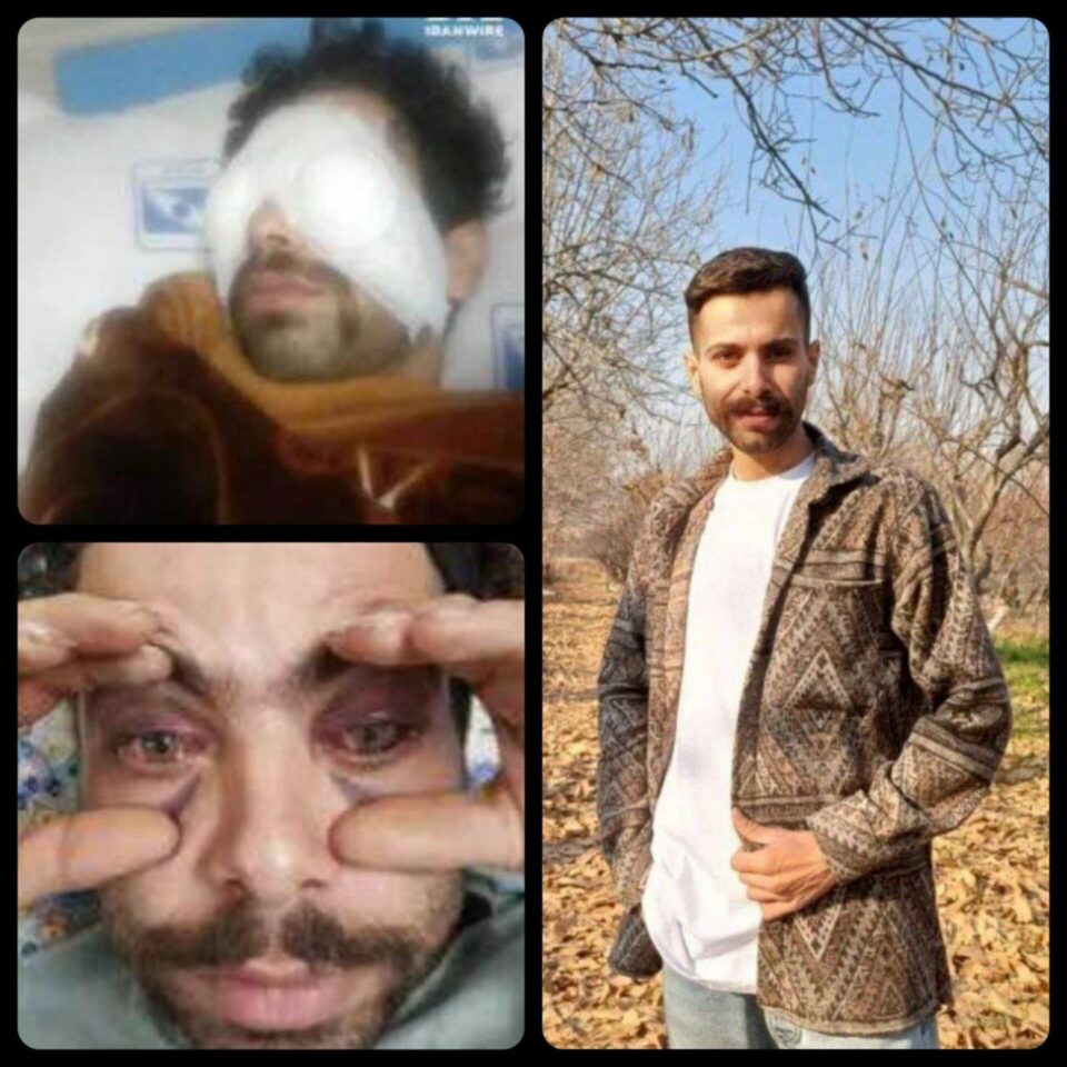 گیانله‌ده‌ستدانی بریندارێكی شۆڕشی خه‌زه‌ڵوه‌ری ٩٨ 1