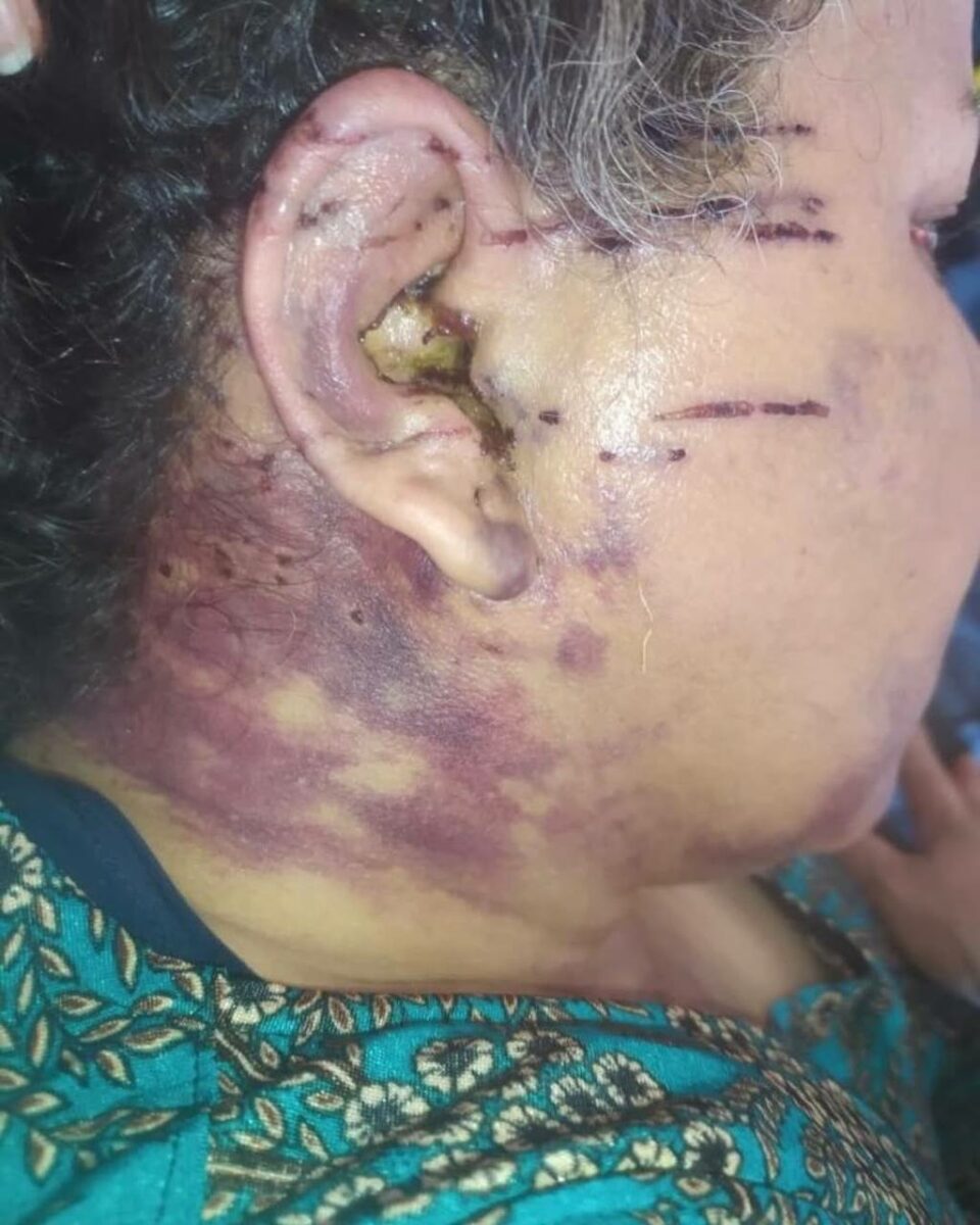 دۆخی خراپی بریندارێكی شۆڕشی ژینا له‌ بۆكان 2