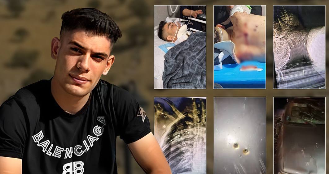 برینداربوونی مێرمنداڵێكی ته‌مه‌ن ١٧ ساڵ به‌ ته‌قه‌ی هێزه‌كانی ڕژیم