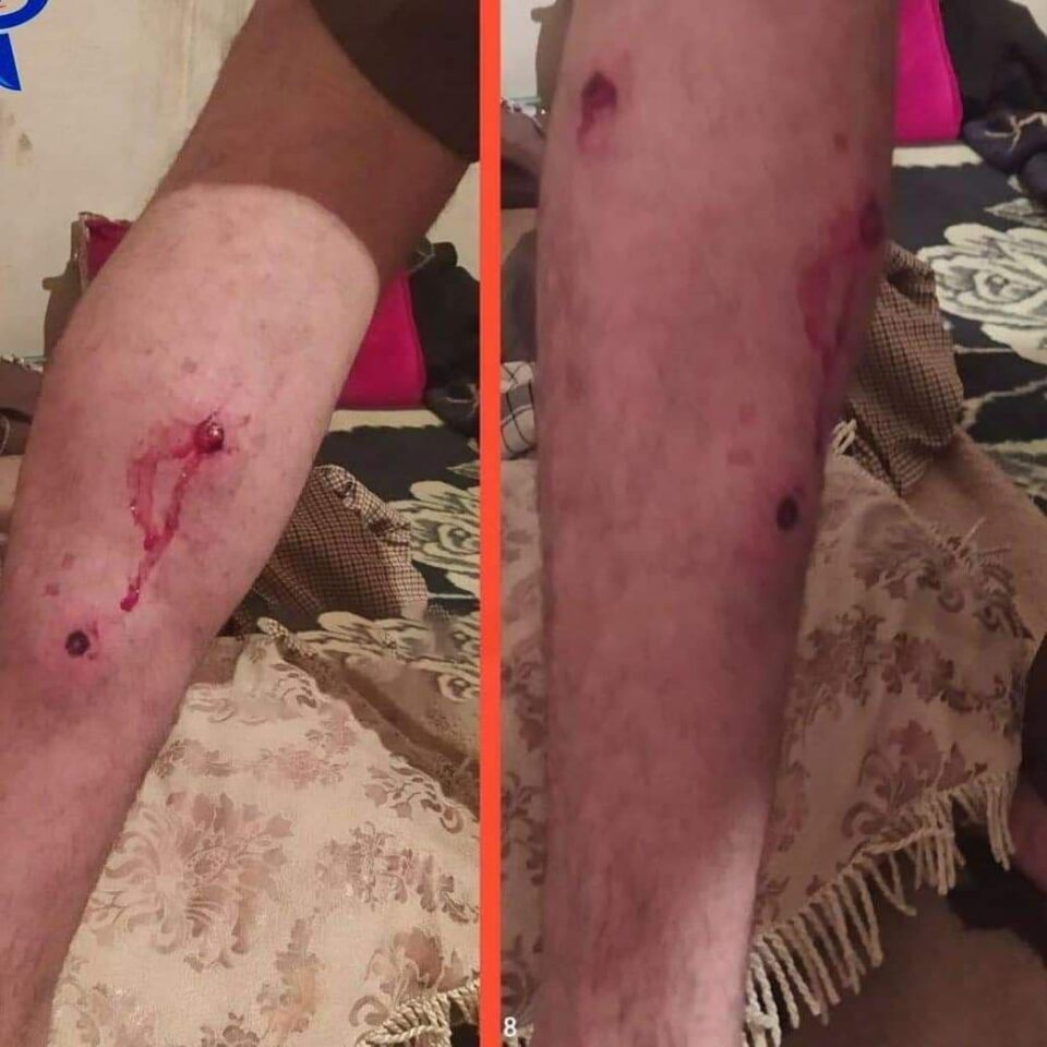 بریندار بوونی كۆڵبه‌رێك له‌ سنووره‌كانی نه‌وسوود 1