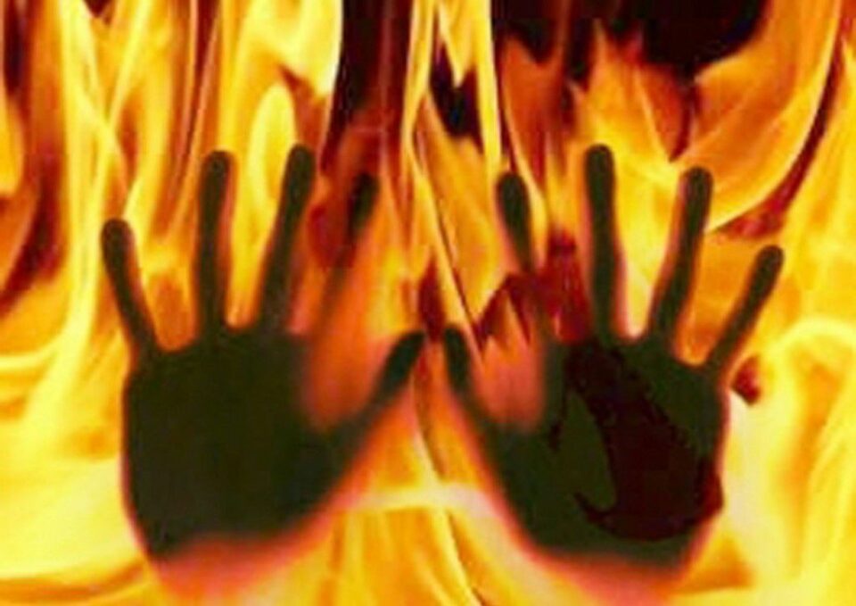 ئاگرتێبەردانی ژنێک لە خەودا لەلایەن هاوسەرەکەی 2