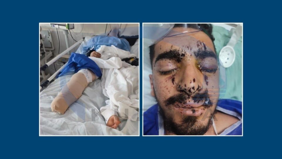 ناجێگیربوونی بارودۆخی تەندرووستی کۆڵبەرە بریندار بووەکەی خەڵکی سەردەشت