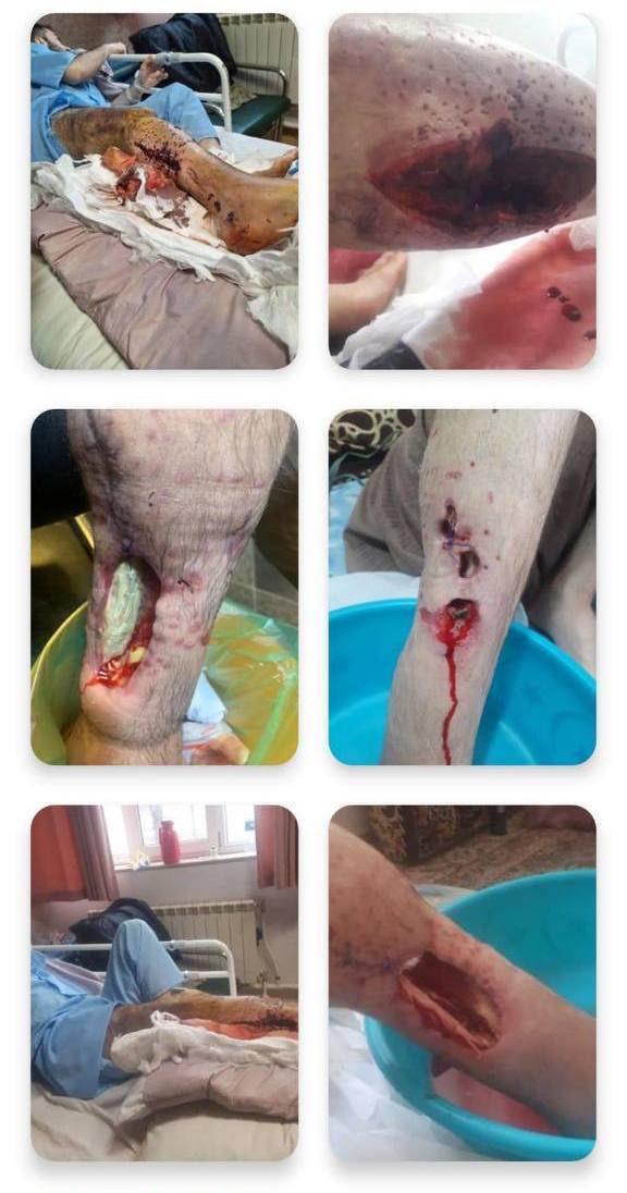 دۆخی خراپی ته‌ندرووستی كۆڵبه‌رێكی بریندار له‌ بانه