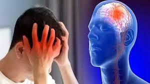 هه‌بوونی ١٢٠ هه‌زار تووشبووی نه‌خۆشی ام.اس له‌ ئێران