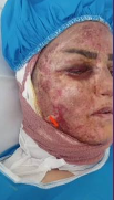 پژاندی ئه‌سید به‌ سه‌ر ڕوومه‌تی ژنێك له‌ جوانڕۆ